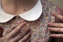 痣相图解:什么是朱砂痣