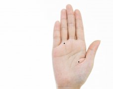 痣相图解:掌中有痣会孤独一生吗